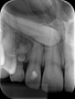 Radiografia Periapical