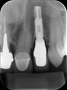 Radiografia Periapical