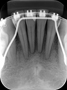 Radiografia Periapical