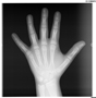 Radiografia Mão e Punho