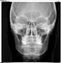 Telerradiografia Frontal