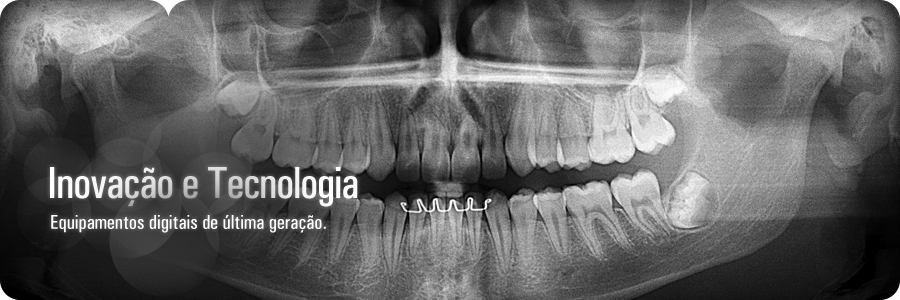 Inovação Tecnologica